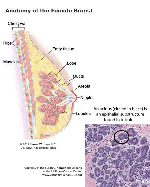 An anatomical diagram of the female breast with the different parts of the breast labeled. There is a smaller image of a cell sample, where an acinus is circled in black, in the lower right corner. 